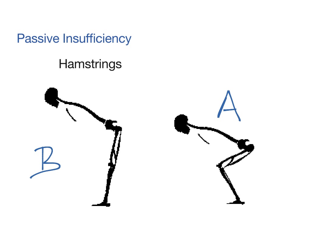 Active And Passive Insufficiency Of Hamstrings Slideshare