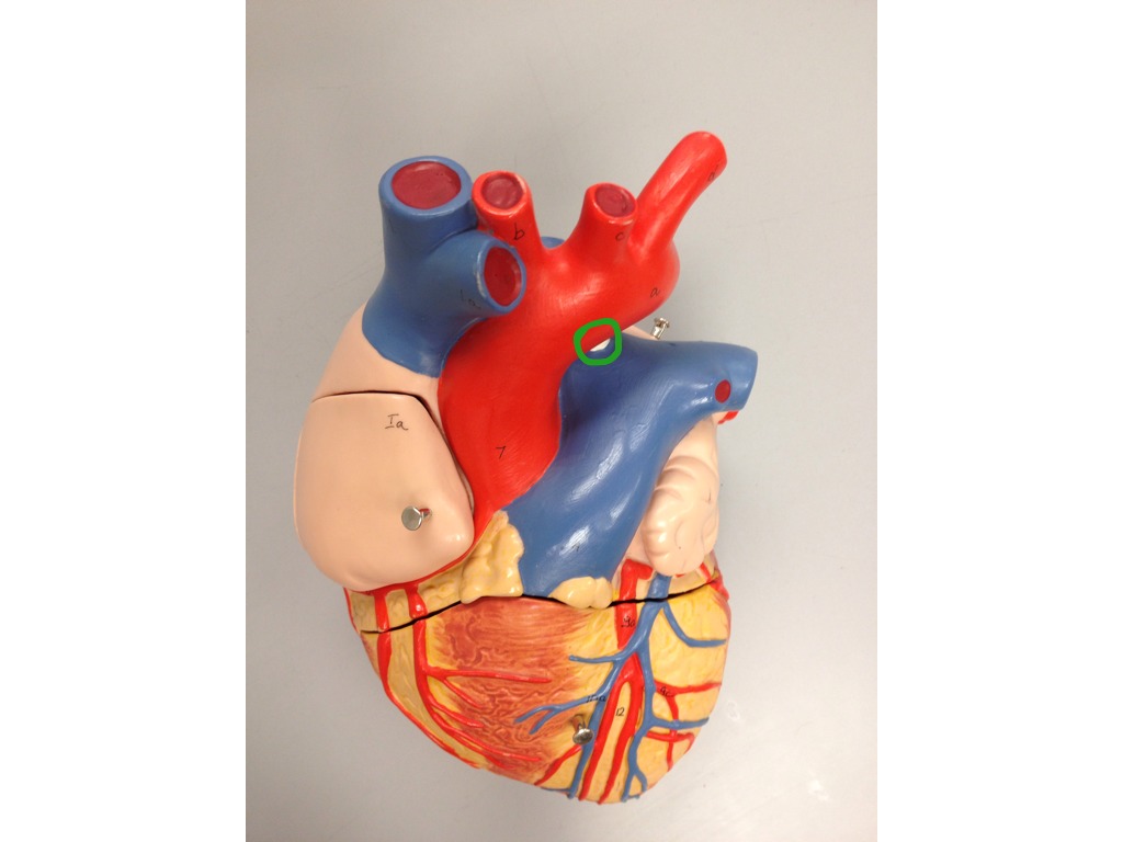 External heart anatomy | Science, Biology, anatomy | ShowMe