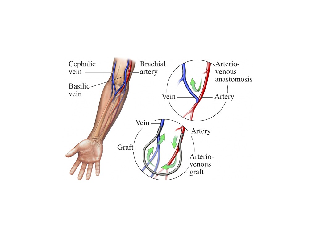 Veins by Ashley Science ShowMe