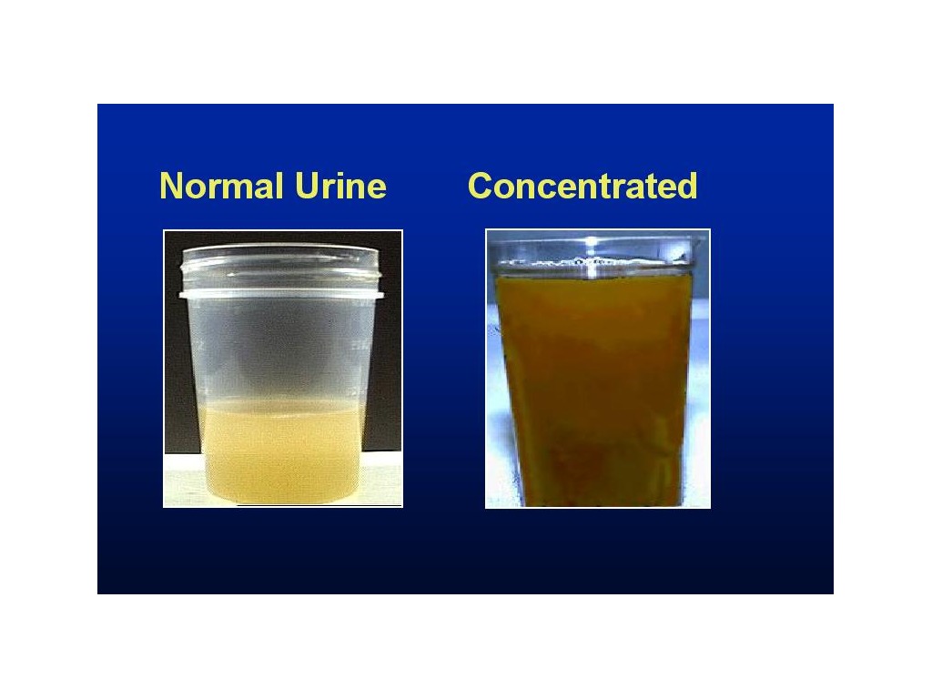 Urinary track infections | Science, Biology, Bacteria | ShowMe