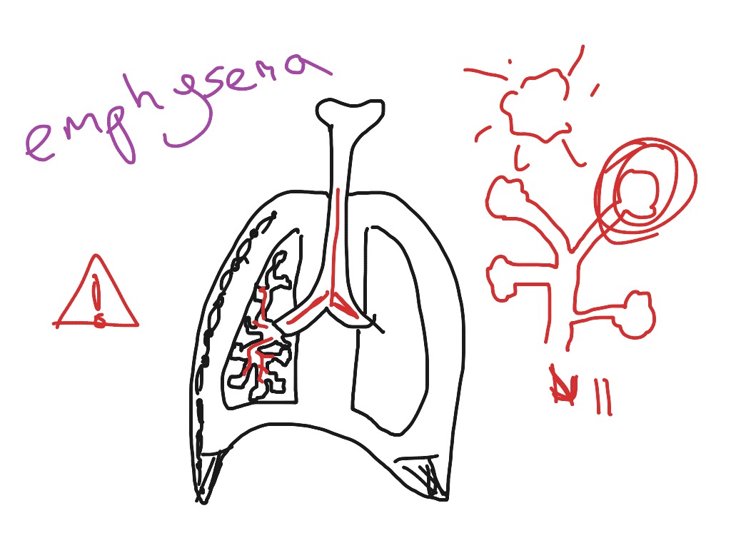 Smoking effects | Science, Biology, Health | ShowMe